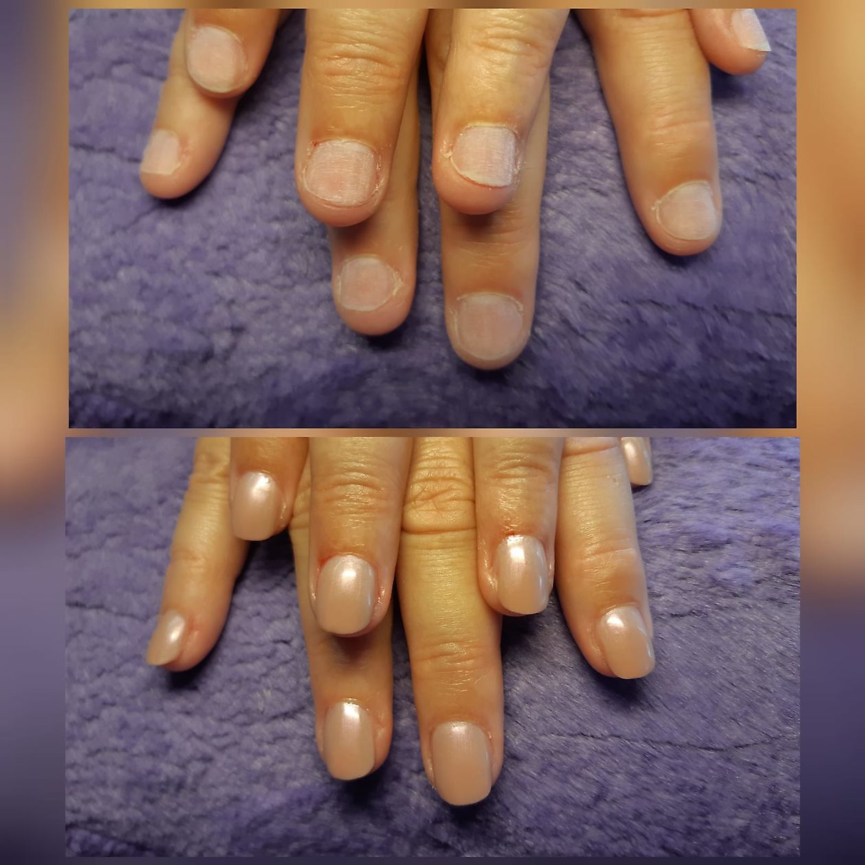 Stop met nagelbijten dankzij acrylnagels! Mirjam's Nagelstudio